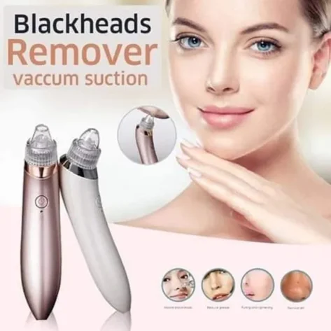 Blackhead Remover Face Acne Black Dot Pimple Electric Black Head Vacuum Cleaner Pore Skin Care Tools Machine 4 Replacement Head (random Color)